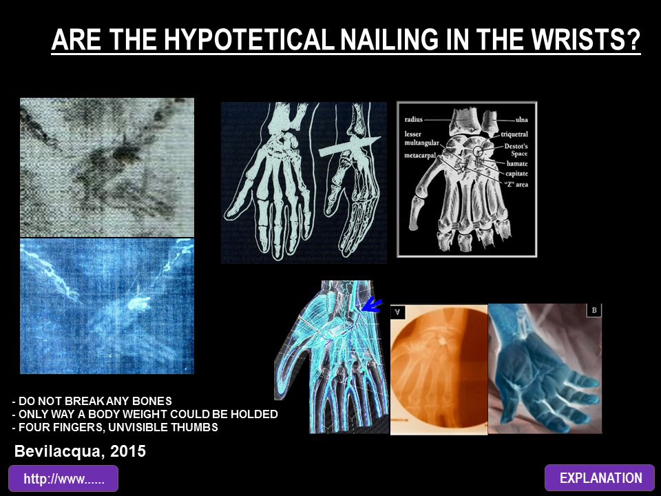 ARE THE HYPOTETICAL NAILING IN THE WRISTS?
