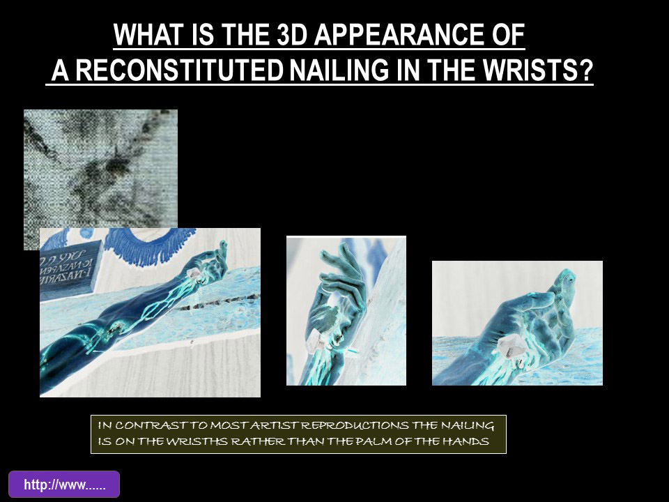 WHAT IS THE 3D APPEARANCE OF A RECONSTITUTED NAILING IN THE WRISTS?