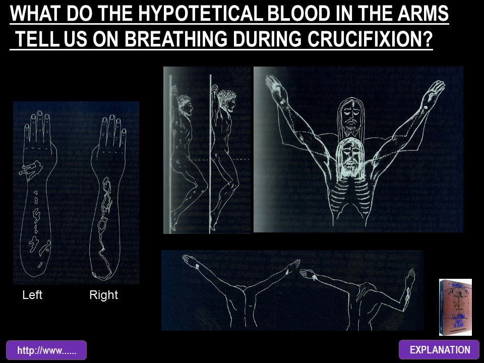 WHAT DO THE HYPOTETICAL BLOOD IN THE ARMS TELL US ON BREADING DURING CRUCIFIXION?