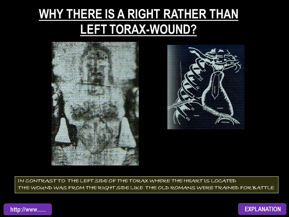 WHY THERE IS A RIGHT RATHER THAN LEFT TORAX-WOUND?