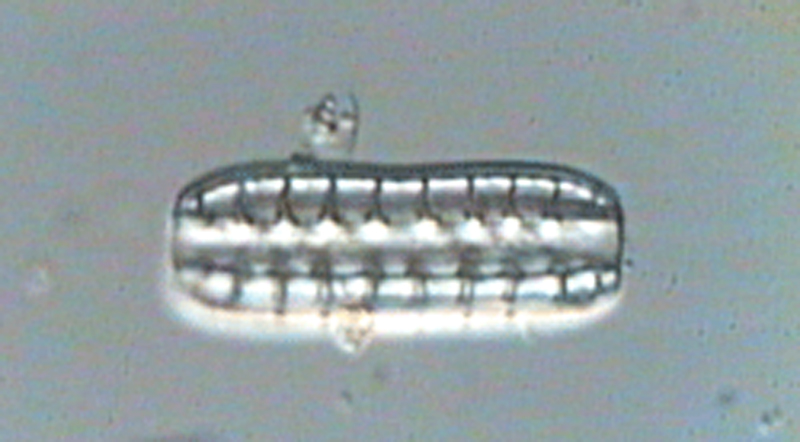denticula_elegans